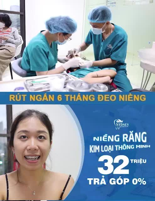 NIỀNG RĂNG MẮC CÀI KIM LOẠI THÔNG MINH VÀ 5 ƯU ĐIỂM NỔI BẬT