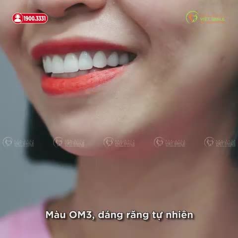 NỤ CƯỜI VẪN TỰ TIN RẠNG RỠ SAU 4 NĂM BỌC RĂNG SỨ