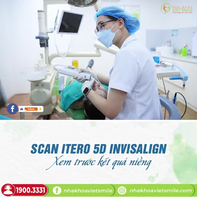 SCAN ITERO 5D - LẤY DẤU HÀM NHANH CHÓNG CHỈ 60S
