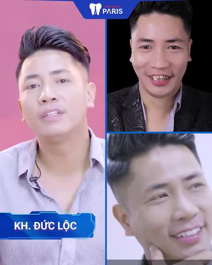 TOP 5 CA BỌC RĂNG SỨ KHÓ NHẤT