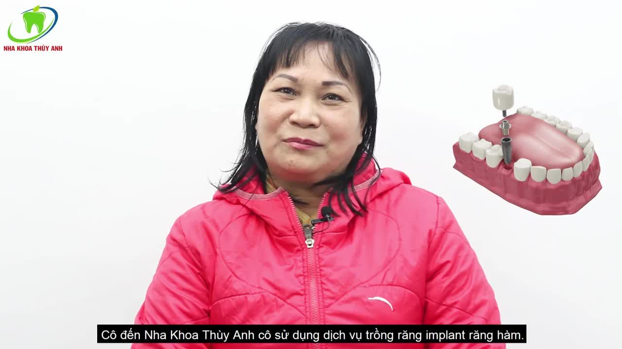 TRỒNG RĂNG IMPLANT - HIỆU QUẢ BỀN VỮNG, LÂU DÀI