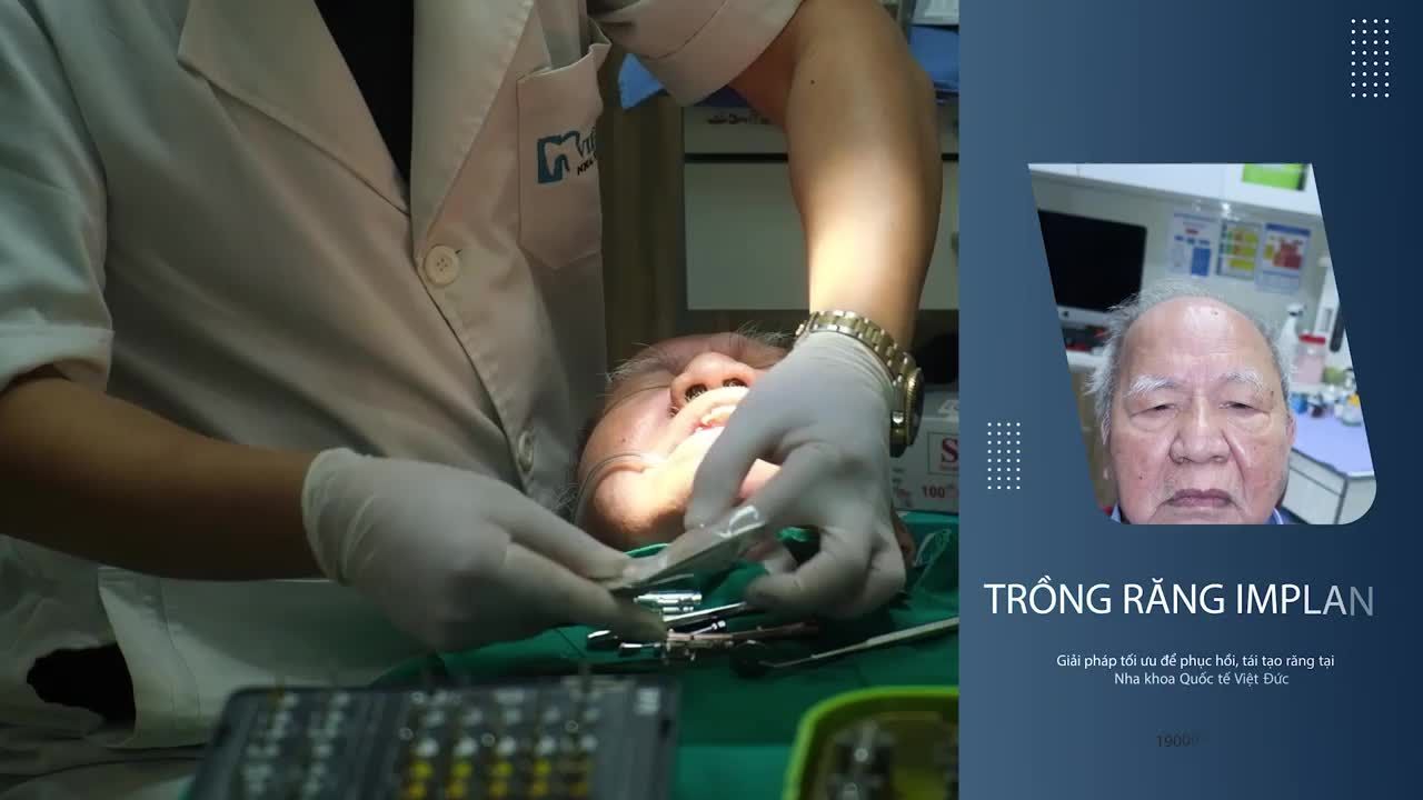 TRỒNG RĂNG IMPLANT VỚI BÁC SĨ MẬU