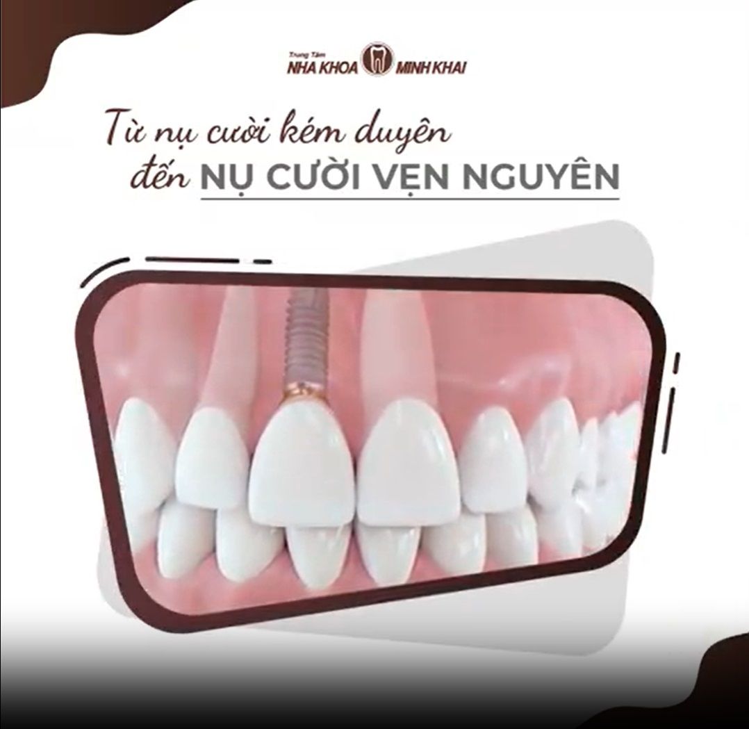 TỪ NỤ CƯỜI KÉM DUYÊN, ĐẾN NỤ CƯỜI VẸN NGUYÊN