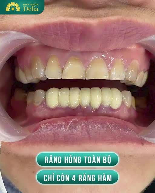Delia hỗ trợ chi phí đi lại từ sân bay đối với khách hàng Việt Kiều hồi hương