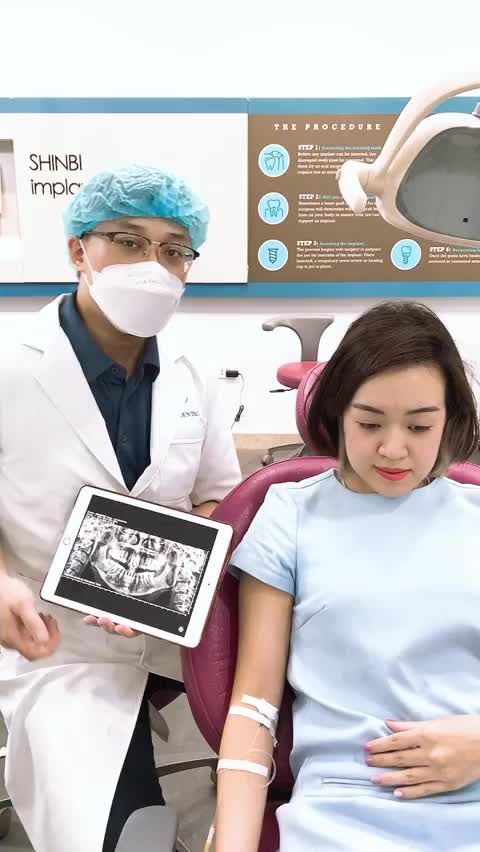 XỬ LÝ CA NHỔ RĂNG SỐ 8 KHÓ MỌC LỆCH 90 ĐỘ