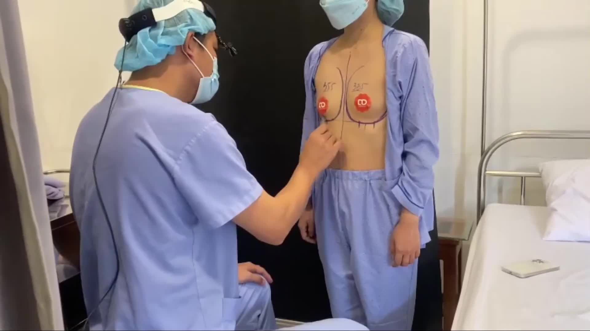Chị khách gặp phải tình trạng teo tuyến vú sau sinh, ngực lệch nhau nhiều về thể tích.