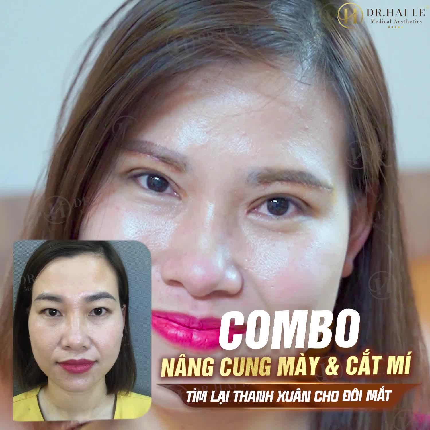 COMBO NÂNG CUNG MÀY CẮT MÍ - TÌM LẠI THANH XUÂN CHO ĐÔI MẮT