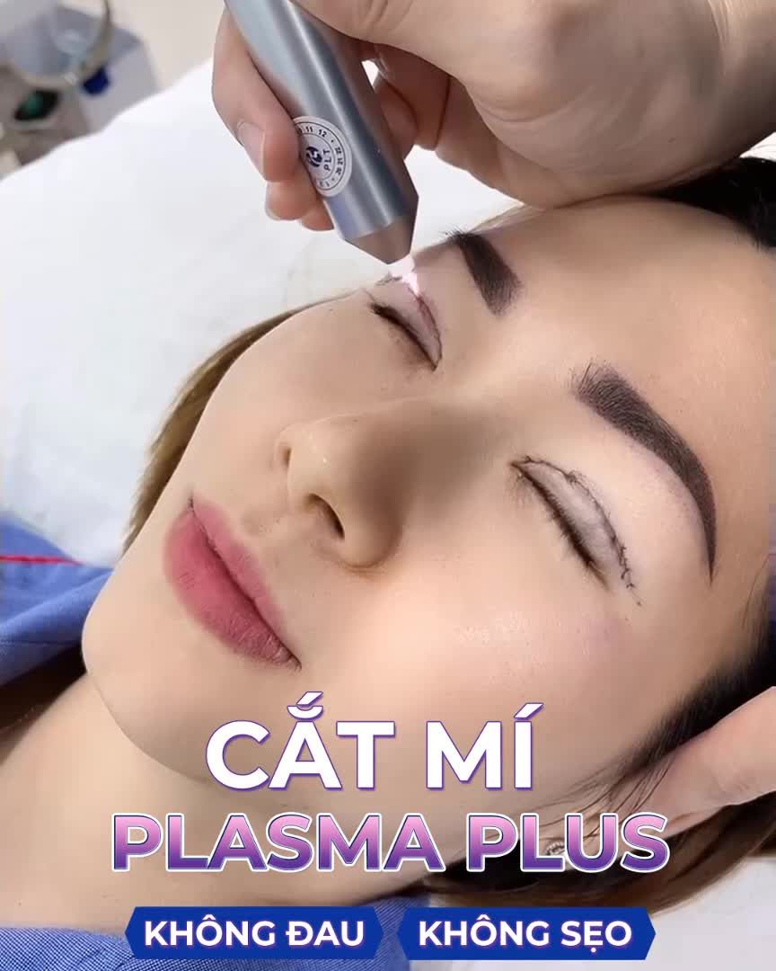 Quá trình chiếu tia Plasma lạnh sau Cắt mí