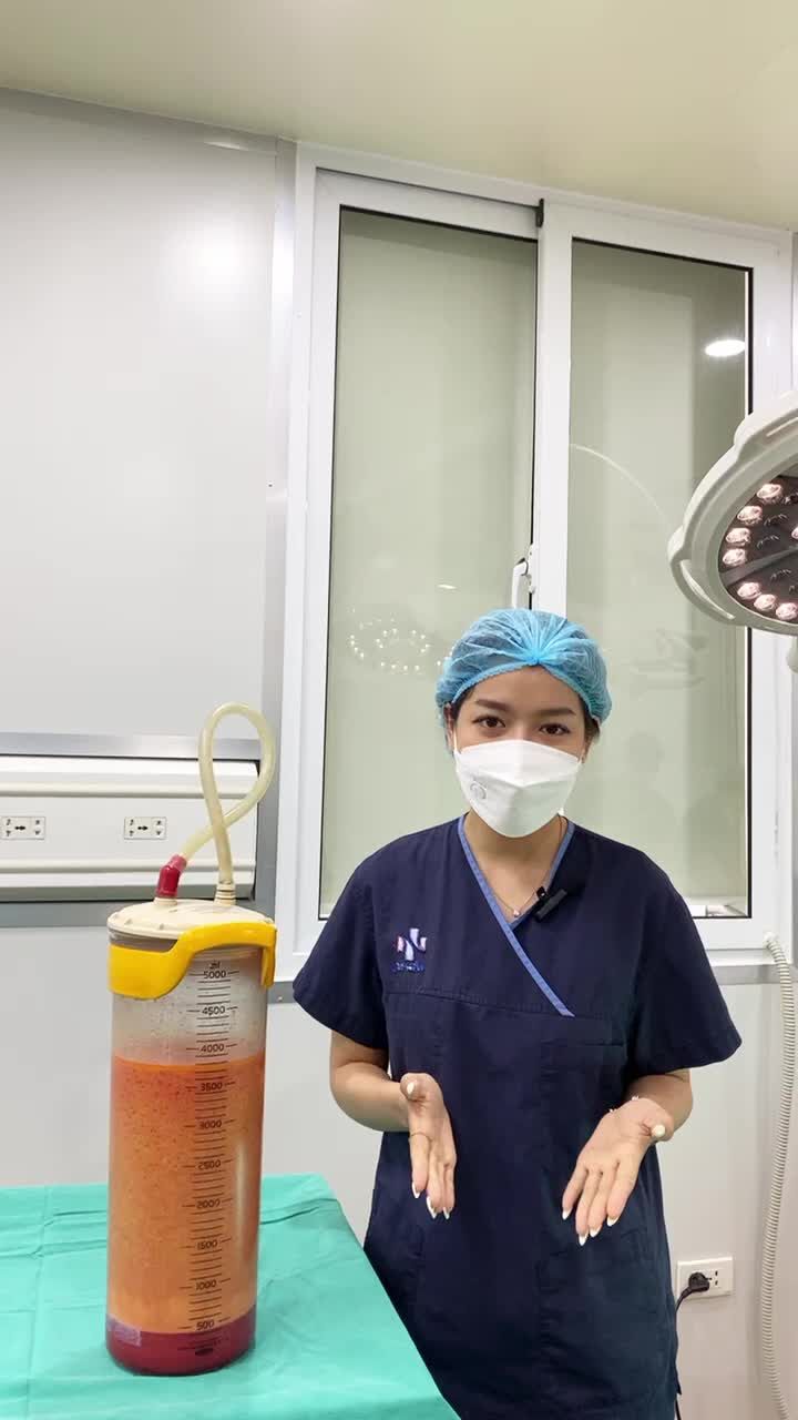 THU NHỎ V1 PHÌ ĐẠI + HÚT MỠ BỤNG