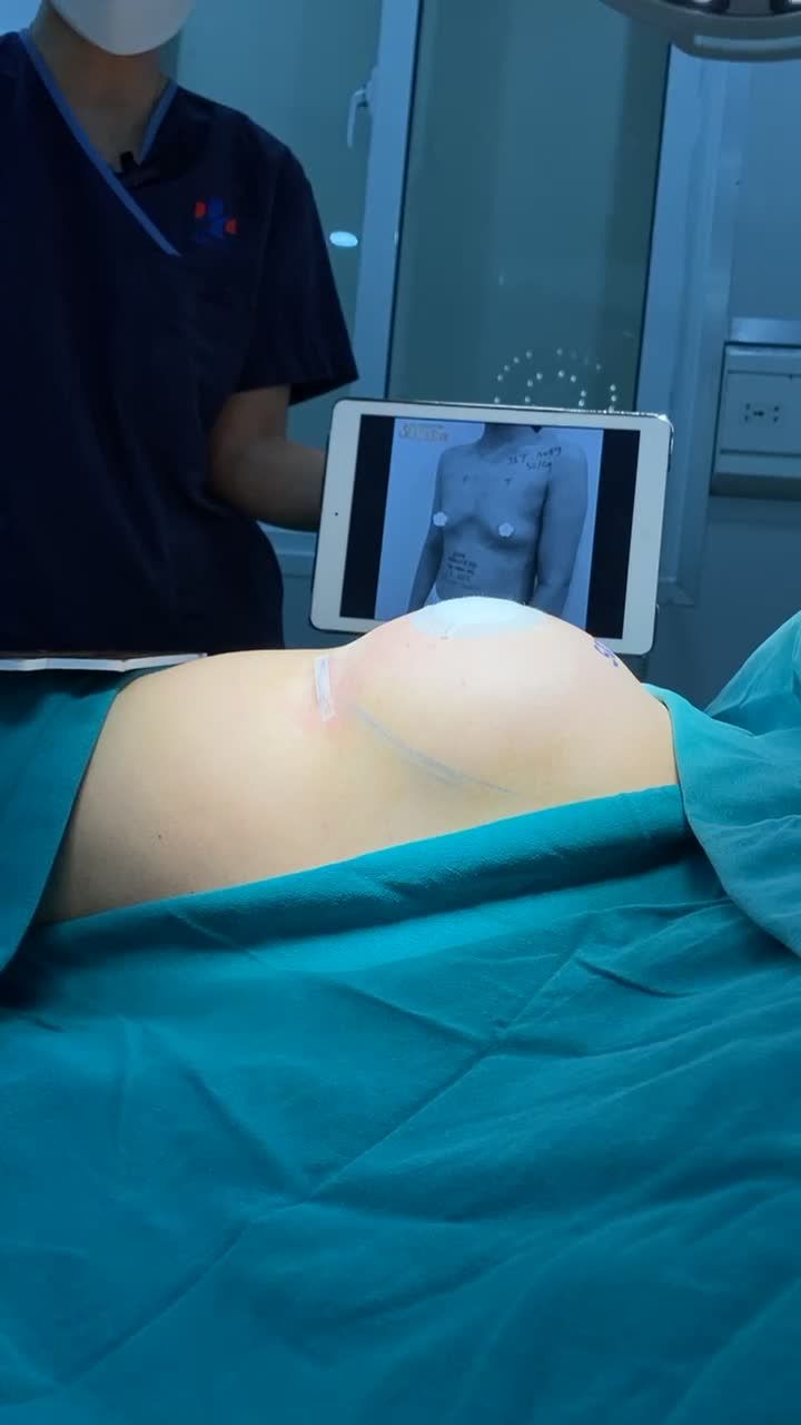 V1 ĐẸP HẾT Ý - CHI PHÍ KHÔNG ĐAU VÍ