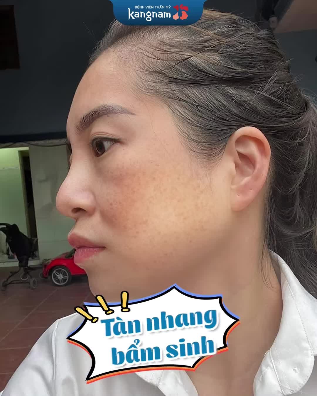 Hành trình vạn dặm tìm thuốc cho tàn nhang của chị Yến đã kết thúc, nhưng Kangnam vẫn luôn chờ đón hàng ngàn làn da khuyết điểm khác.
