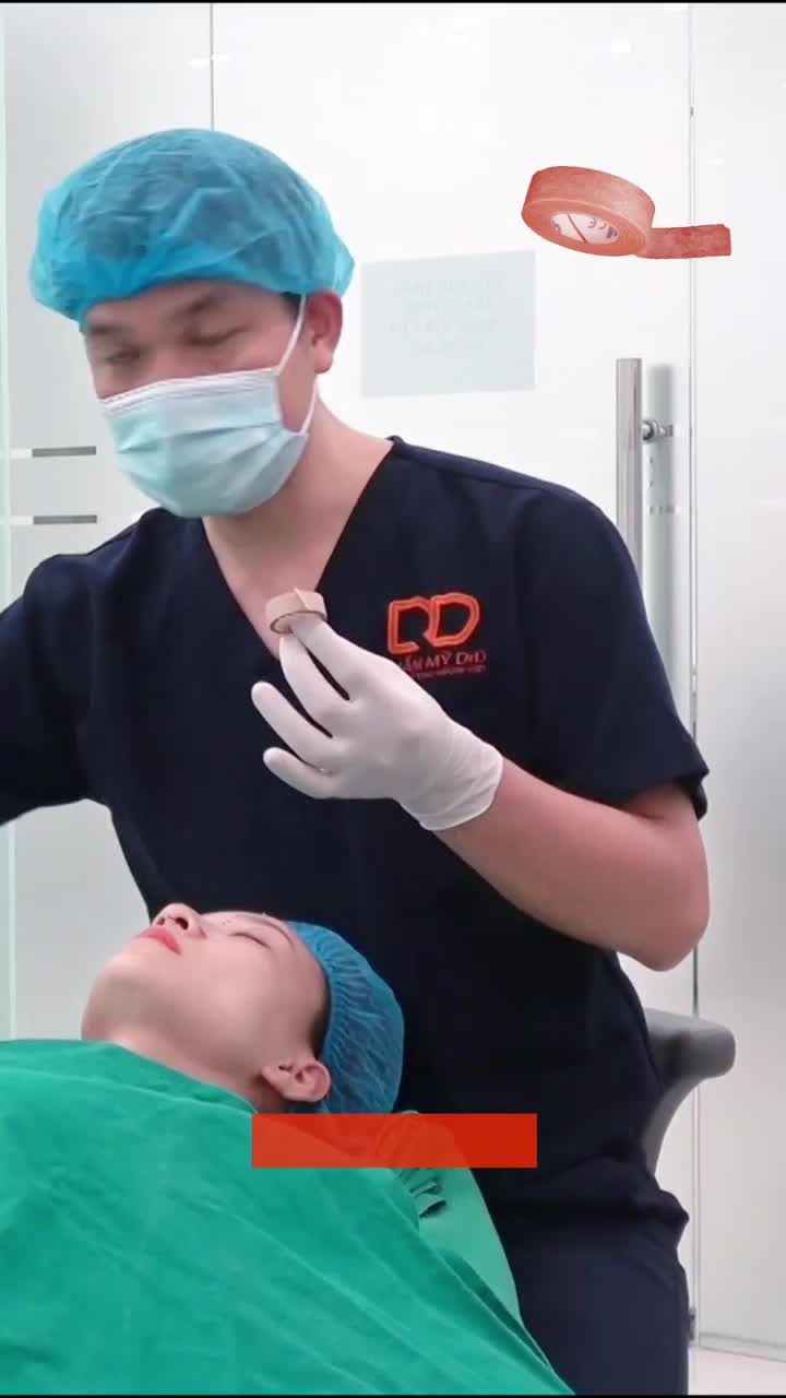 Việc băng nẹp mũi sau khi phẫu thuật nâng mũi là một thao tác cực kỳ quan trọng và bắt buộc cần được thực hiện.