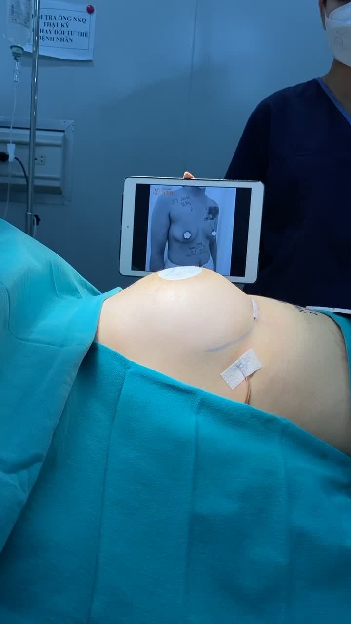CA NÂNG V1 SỐ 4 TRONG NGÀY