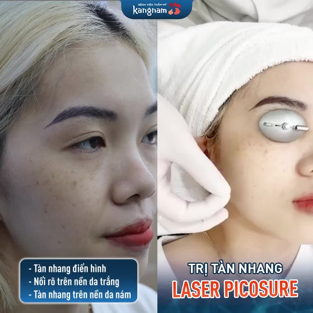 Tình trạng tàn nhang điển hình