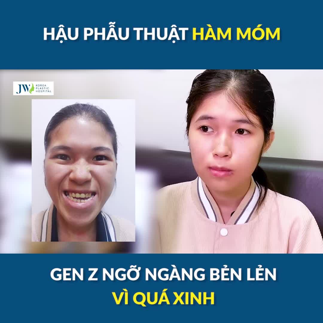 TUYỆT CHIÊU THOÁT Ế Phẫu thuật hàm móm ĐẸP XUẤT THẦN cho cô gái gặp ngay TÌNH YÊU ĐÍCH THỰC
