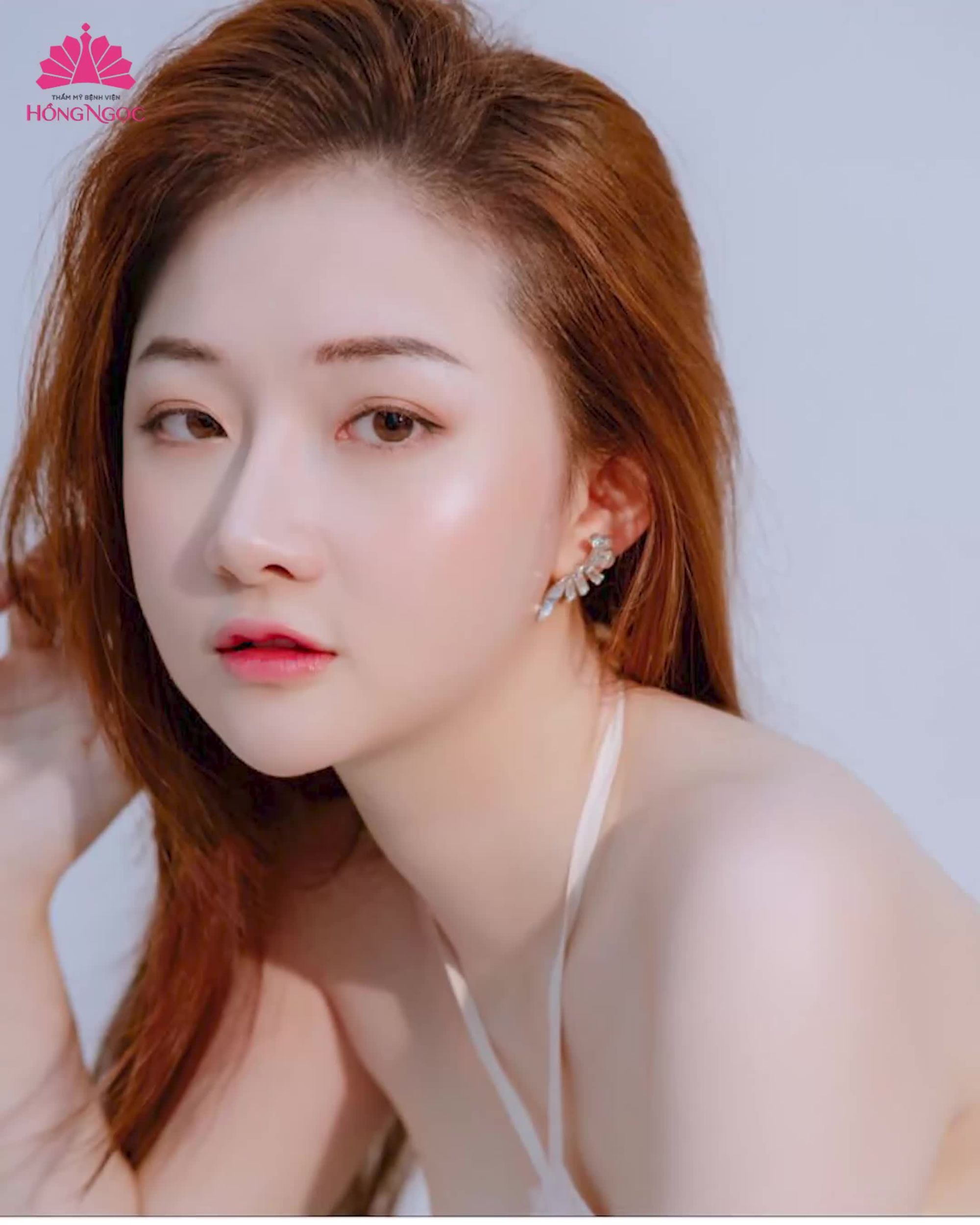 Cứ tới hè là mụn mọc tùm lum, mụn cũ chưa xẹp mà mụn mới lại lên