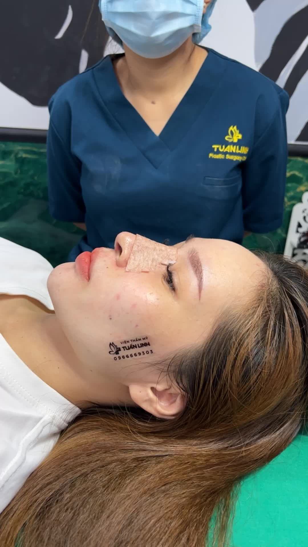 Khoe ngay dáng mũi cấu trúc 10 ngày tuổi