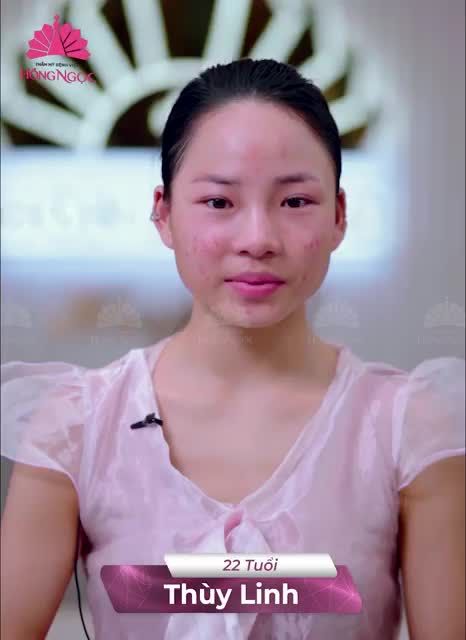 MỤN - NỖI ÁM ẢNH KHÔNG CỦA RIÊNG AI