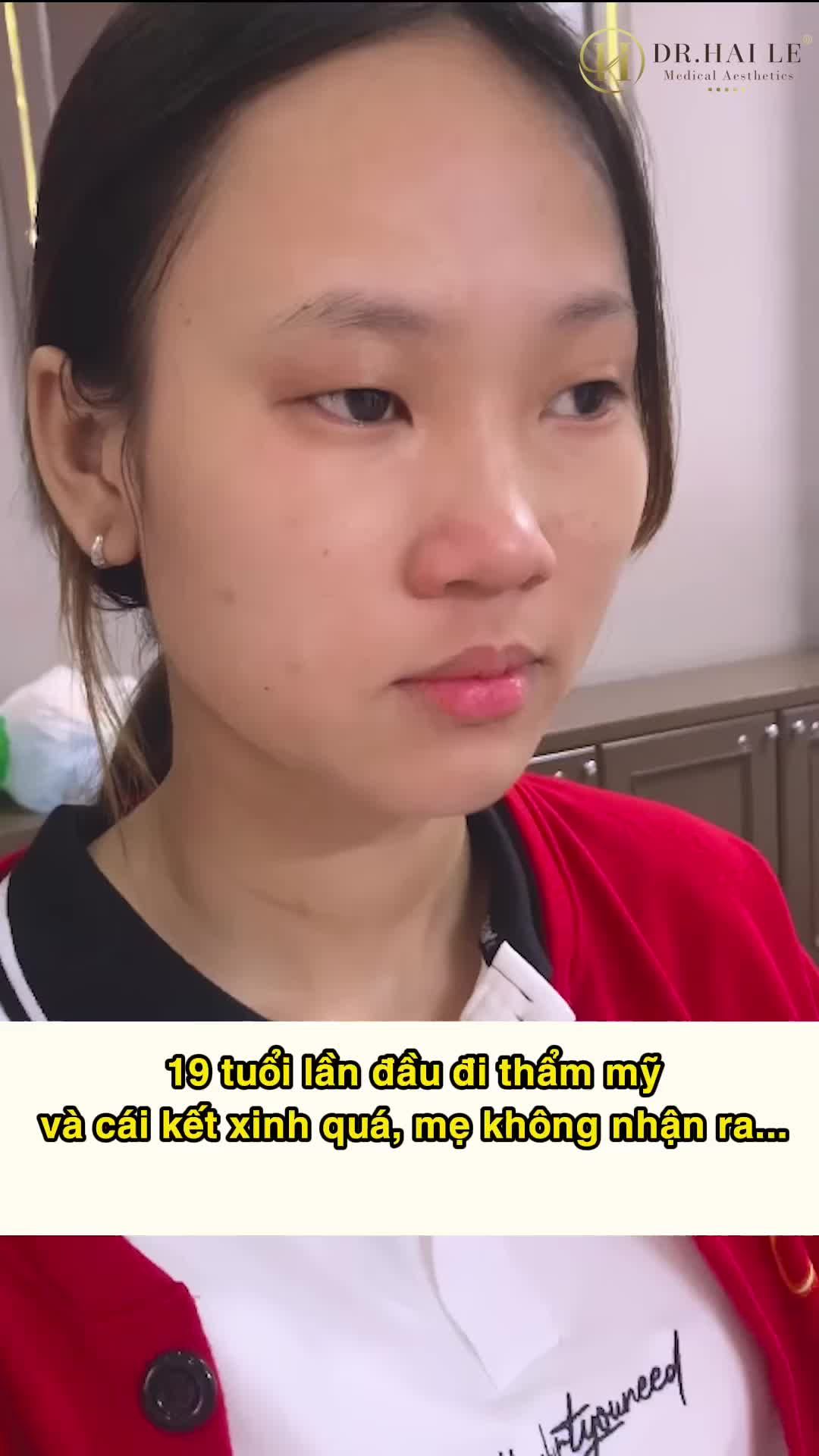 19 tuổi lần đầu đi thẩm mỹ và cái kết xinh quá....mẹ không nhận ra