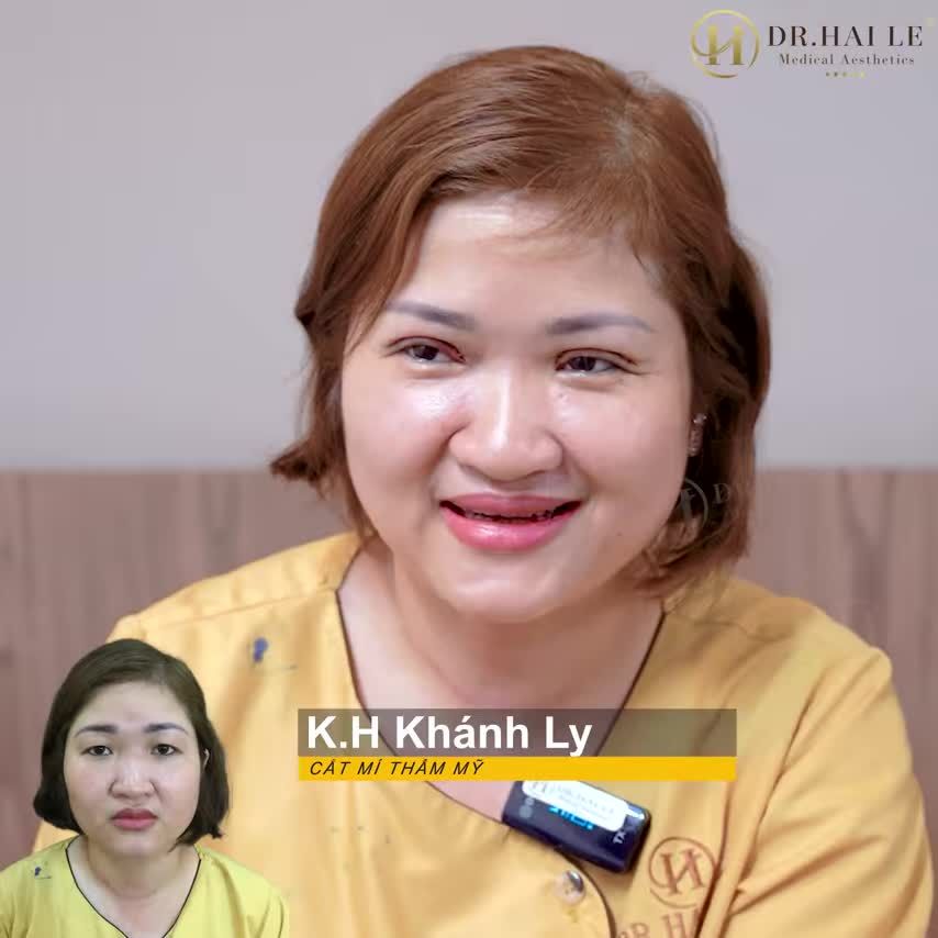 Cắt mí ở Dr.Hải Lê nhiều cái nó lạ lắm..... 45 phút có ngay mí xinh là có thật cả nhà ạ!