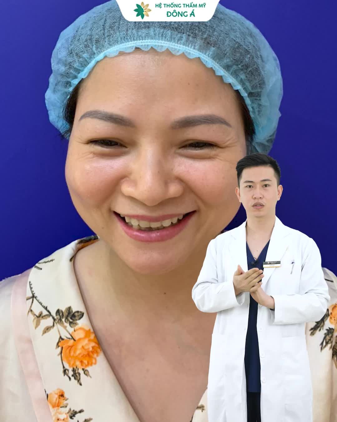 NHIỀU VẾT CHÂN CHIM QUANH MẮT PHẢI LÀM SAO