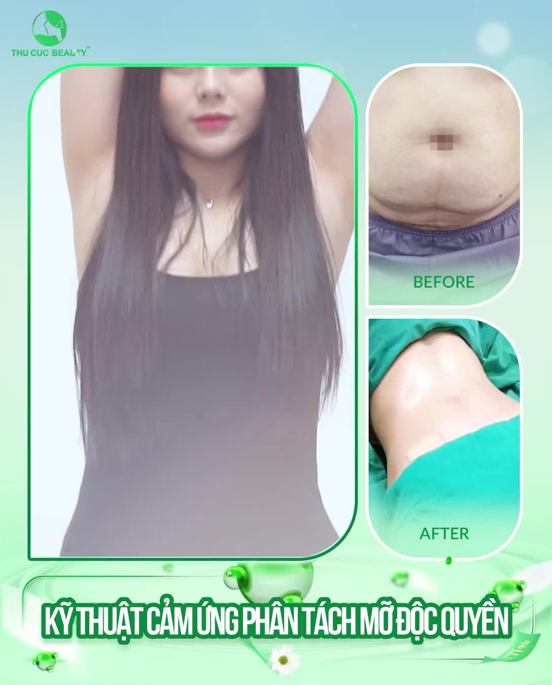 Can thiệp chính xác - Thu gọn tối đa