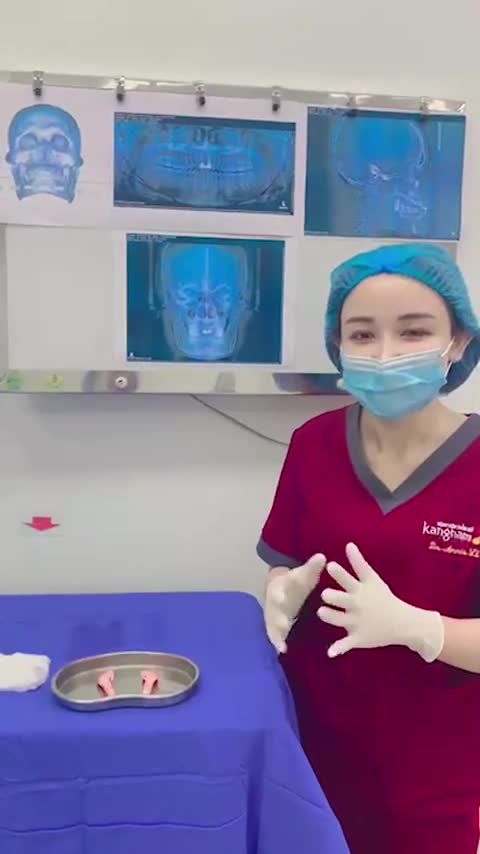 Gọt hàm với công nghệ AI Face Design thông minh hiện đại nhất hiện nay