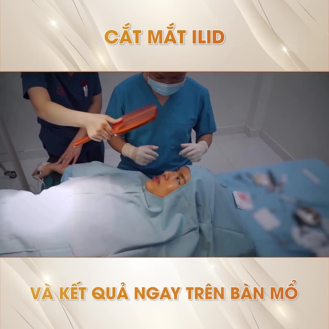 CÁCH CHĂM SÓC SAU CẮT MÍ
