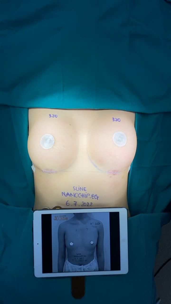 NGƯC ĐẸP SEXY - ƯU ĐÃI HẾT Ý