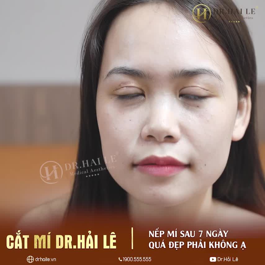 TIN ĐƯỢC KHÔNG CẮT MÍ DR.HẢI LÊ - 7 NGÀY ĐẸP TỰ NHIÊN