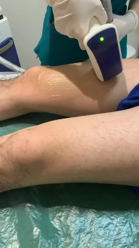 Cận cảnh triệt lông chân cho khách hàng nam tại Đông Á