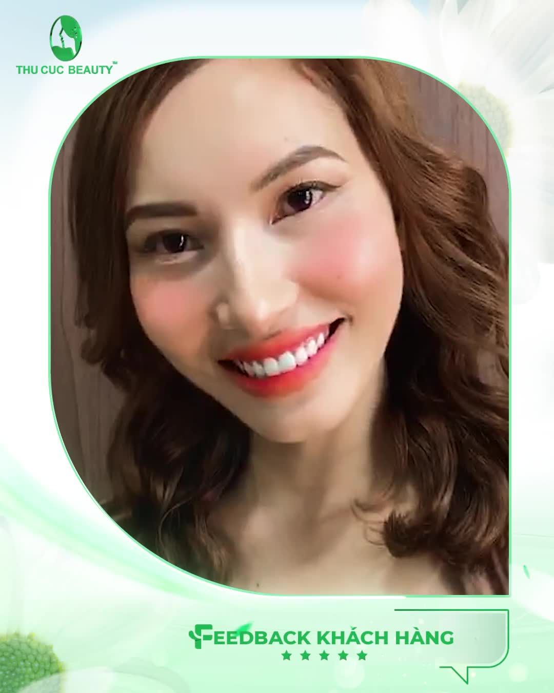 Mê mẩn dáng răng sứ đẹp hoàn hảo của Hotgirl Phương Thảo