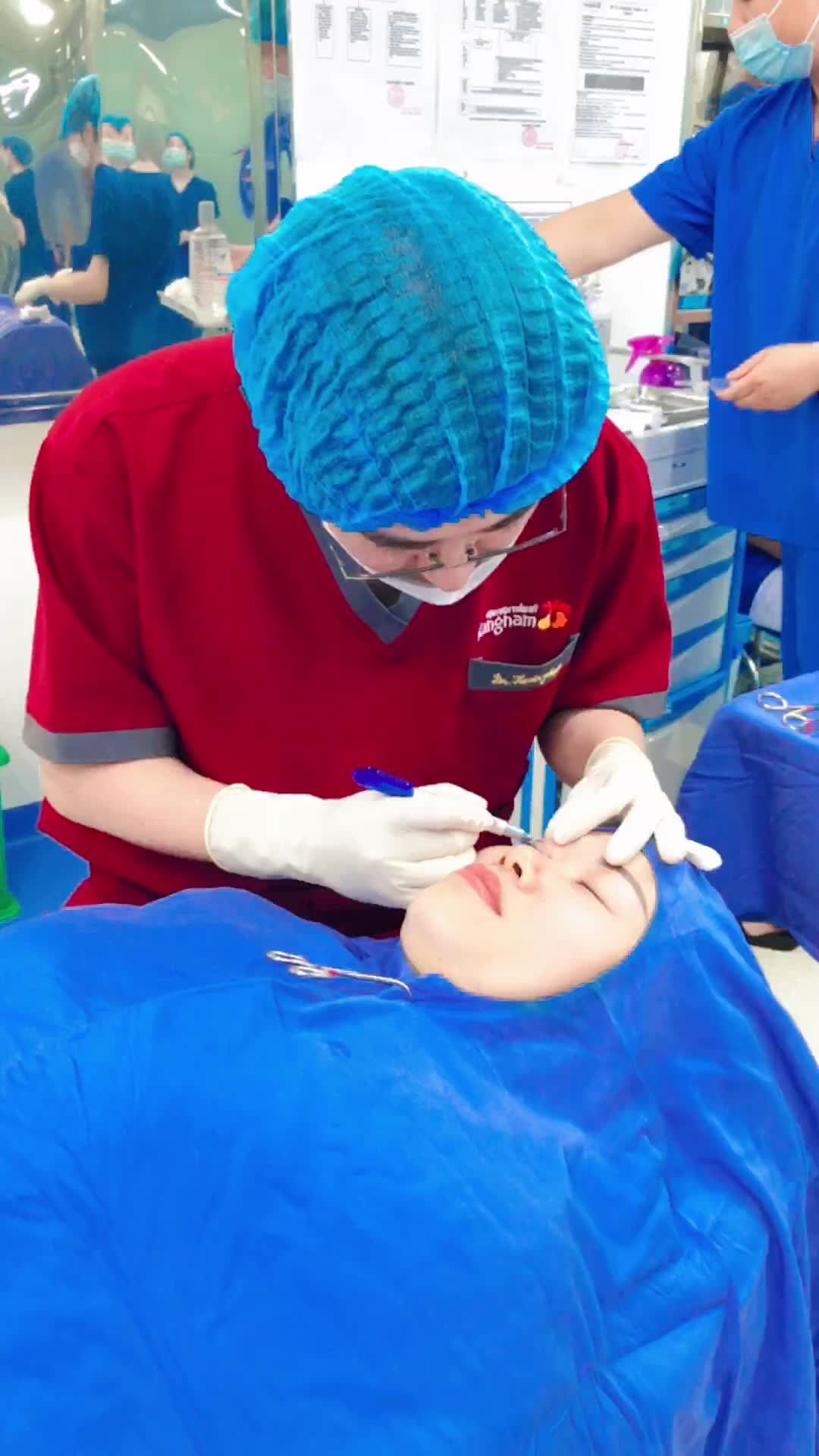 Quá trình đo vẽ Cắt mí Plasma Plus sẽ như thế nào