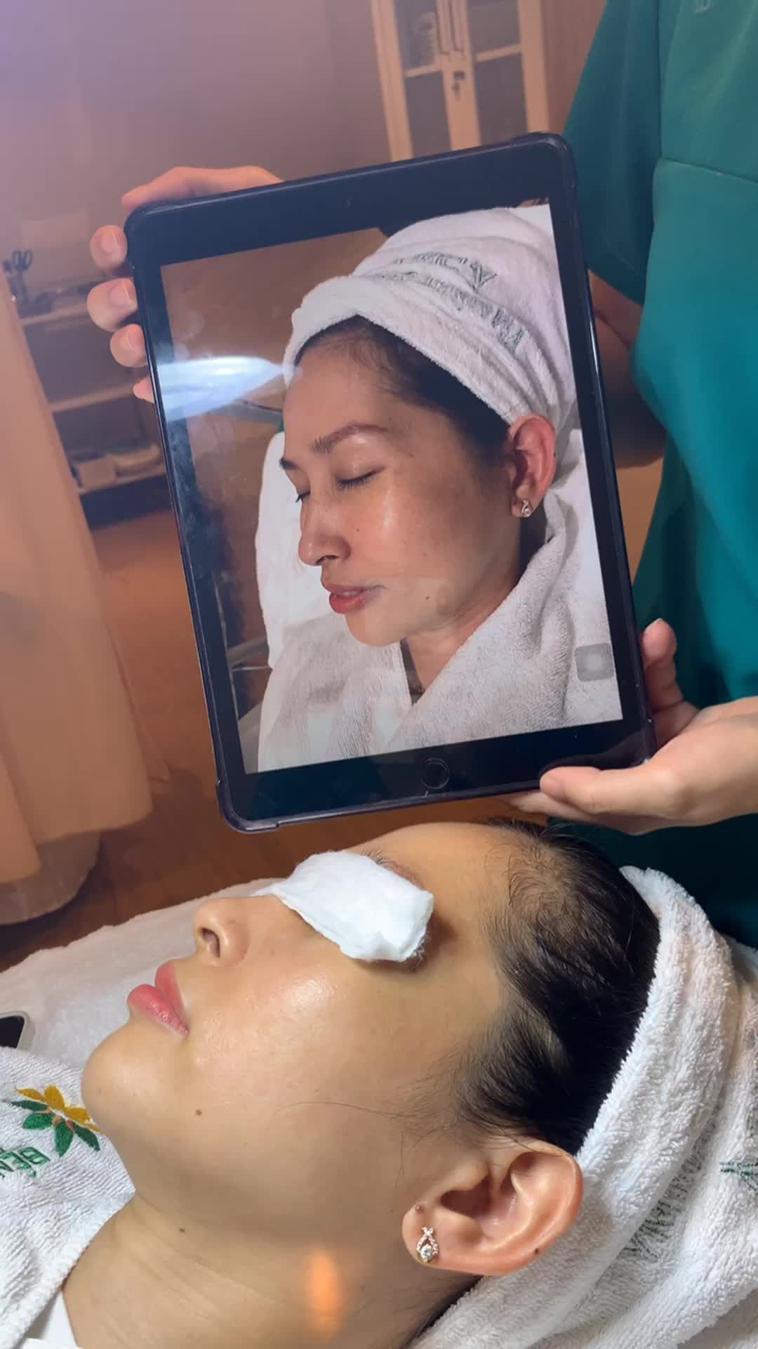 Sạch tàn nhang sau 1 lần làm duy nhất nhờ công nghệ hiện đại tại Đông Á . Xem ngay !!