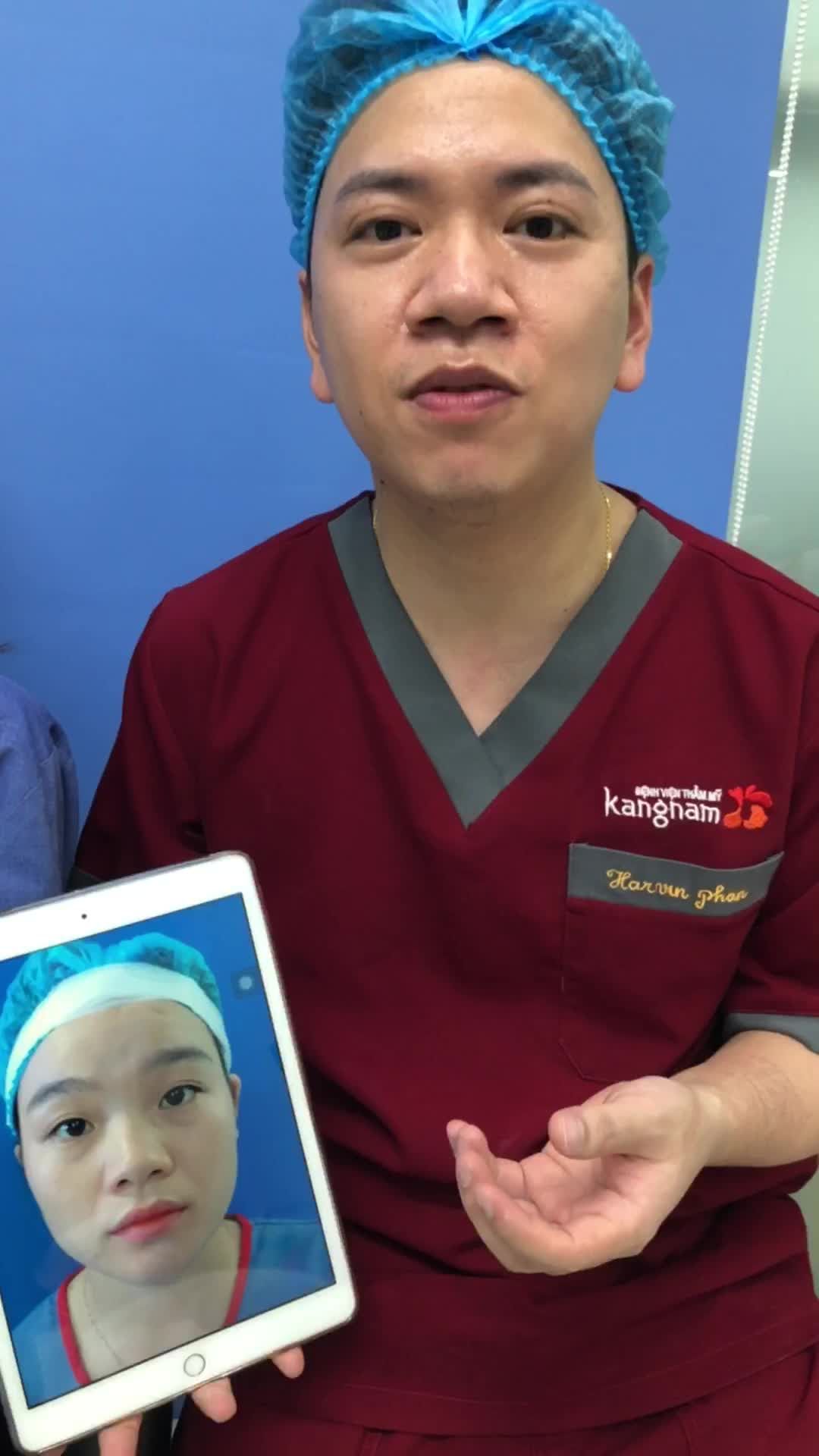 Vừa làm xong có cần đẹp vậy không ạ  Em ưng quá!! - Nâng mũi cấu trúc 6D Surgiform vừa xong của KH Gen Z tại Hà Nội