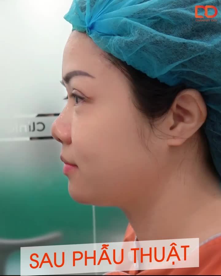 LÃO HÓA KHIẾN MẮT CHÚNG TA TRÔNG NHƯ THẾ NÀO
