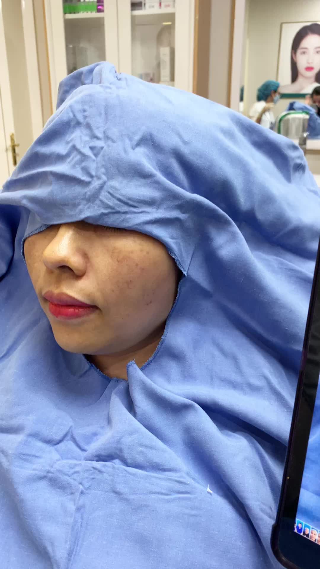Tiêm FILLER làm đầy má hóp! Đẹp tự nhiên sau 20p