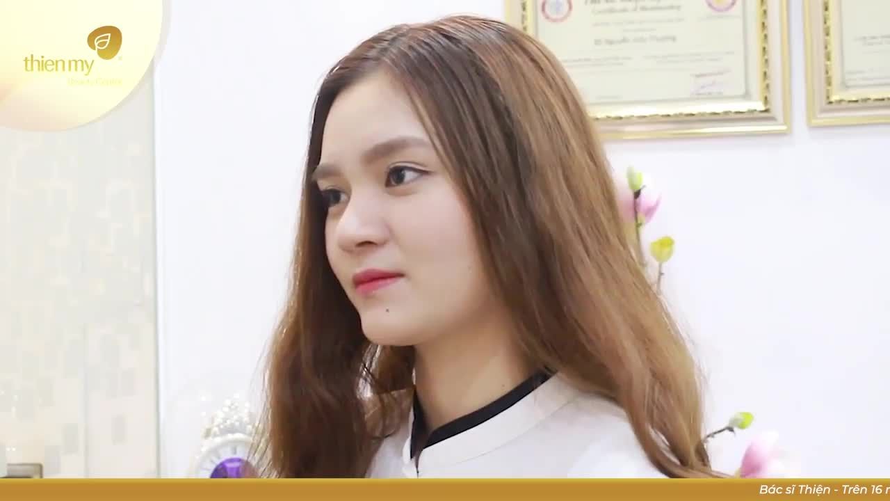 Chia sẻ của chị Uyên sau 5 tháng Nâng mũi 4-S tại Thiện Mỹ