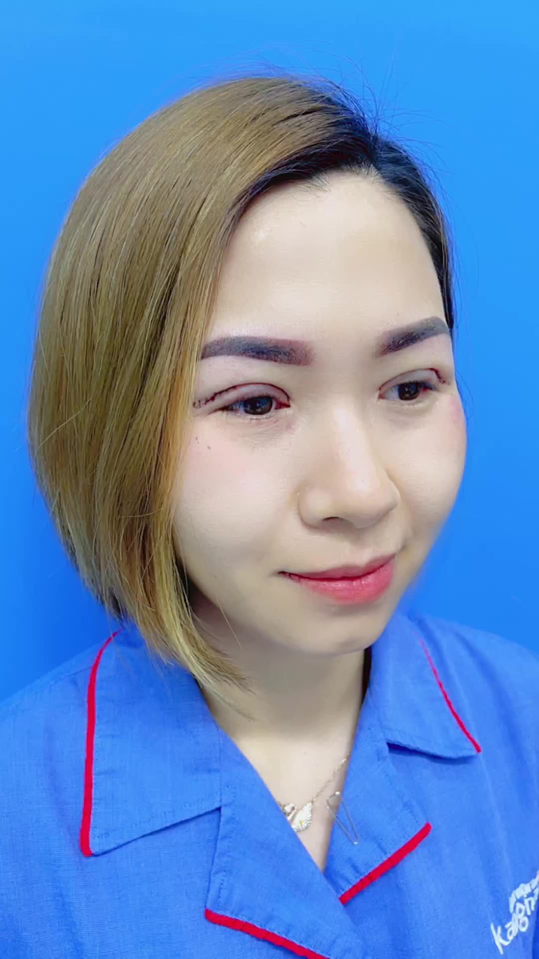 Bất ngờ trước kết quả Cắt mí trên Plasma nhà Kangnam