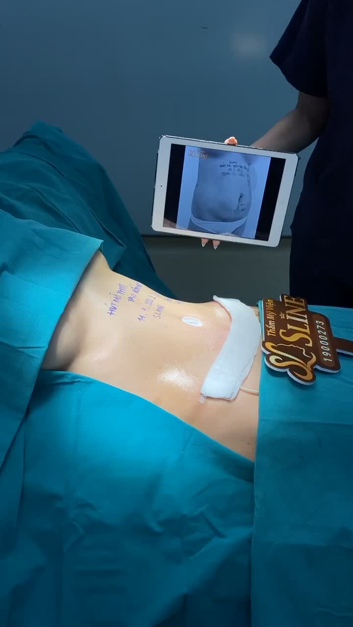 BỤNG NHỎ EO THON - TỰ TIN KHOE DÁNG