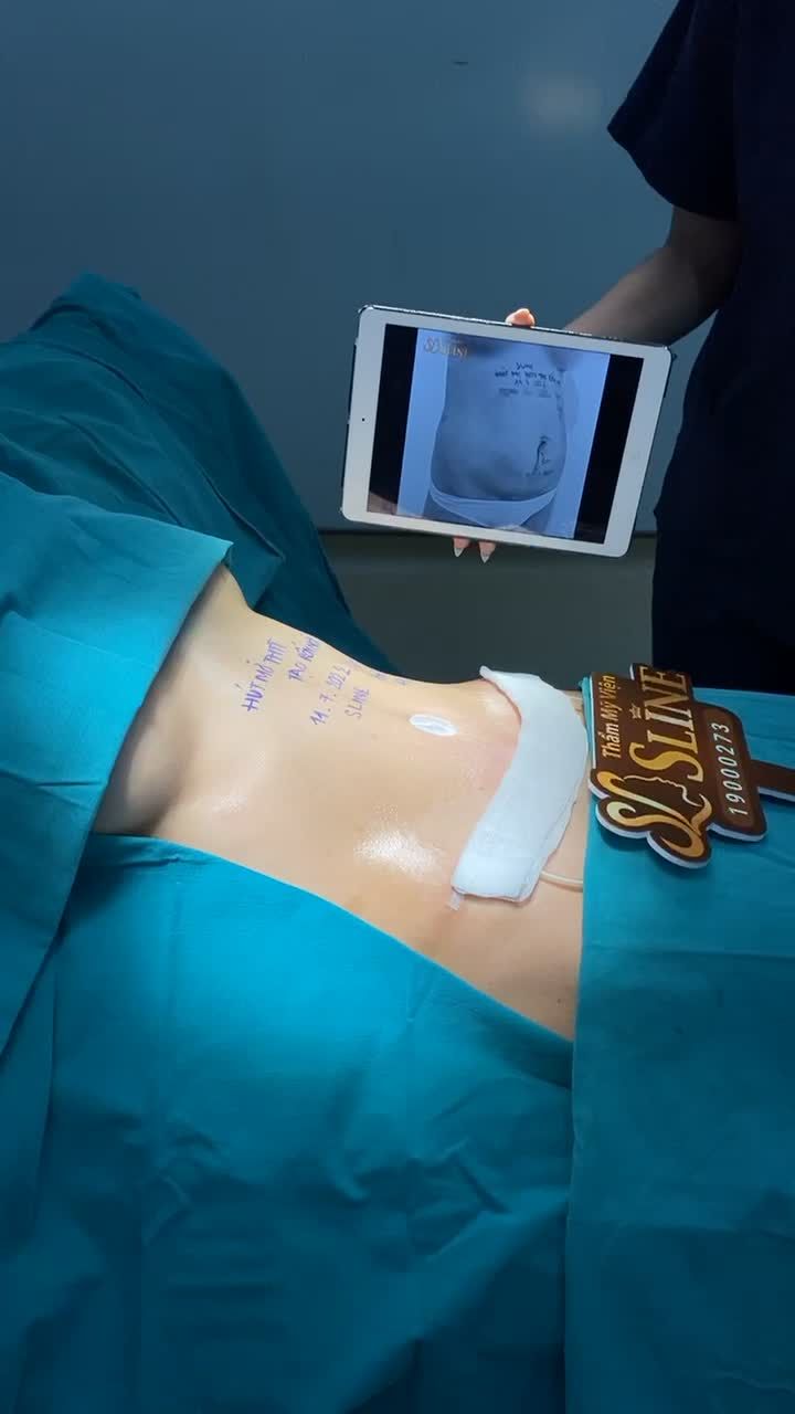 BỤNG NHỎ EO THON - TỰ TIN KHOE DÁNG