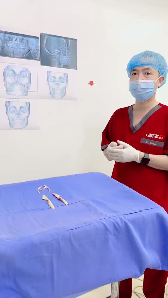 Combo phẫu thuật hàm mặt + Căng da mặt  Kéo lại nhan sắc tuổi xuân cho khách hàng
