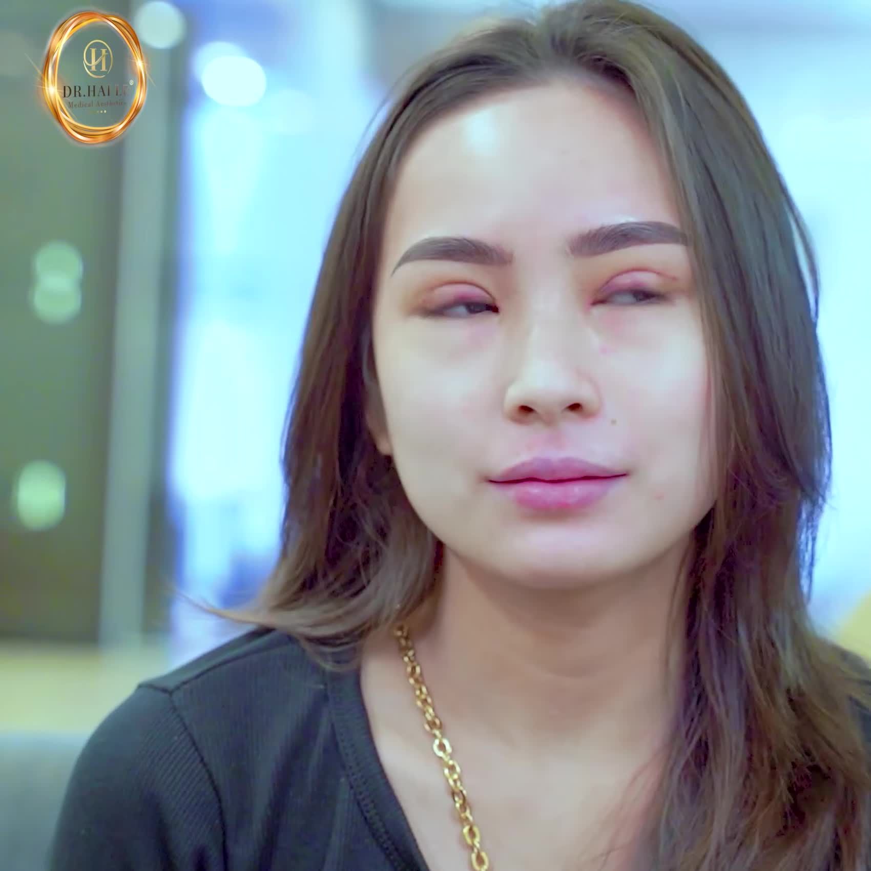 CẮT MÍ DR.HẢI LÊ - VIỆT KIỀU ÚC CÒN PHẢI MÊ!