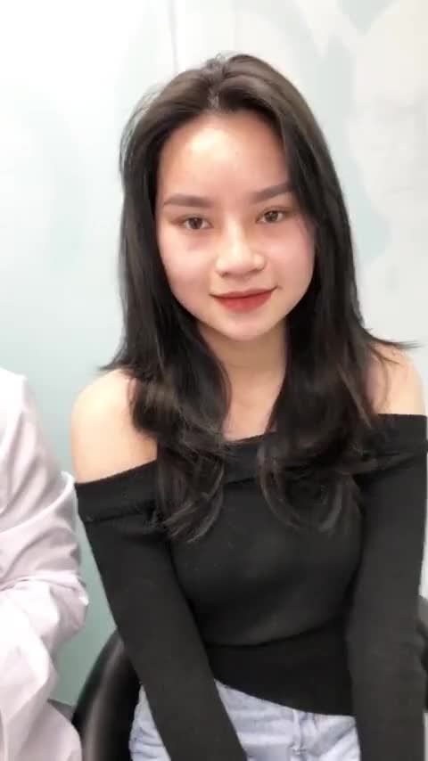 Cực phẩm nâng mũi sau 10 ngày