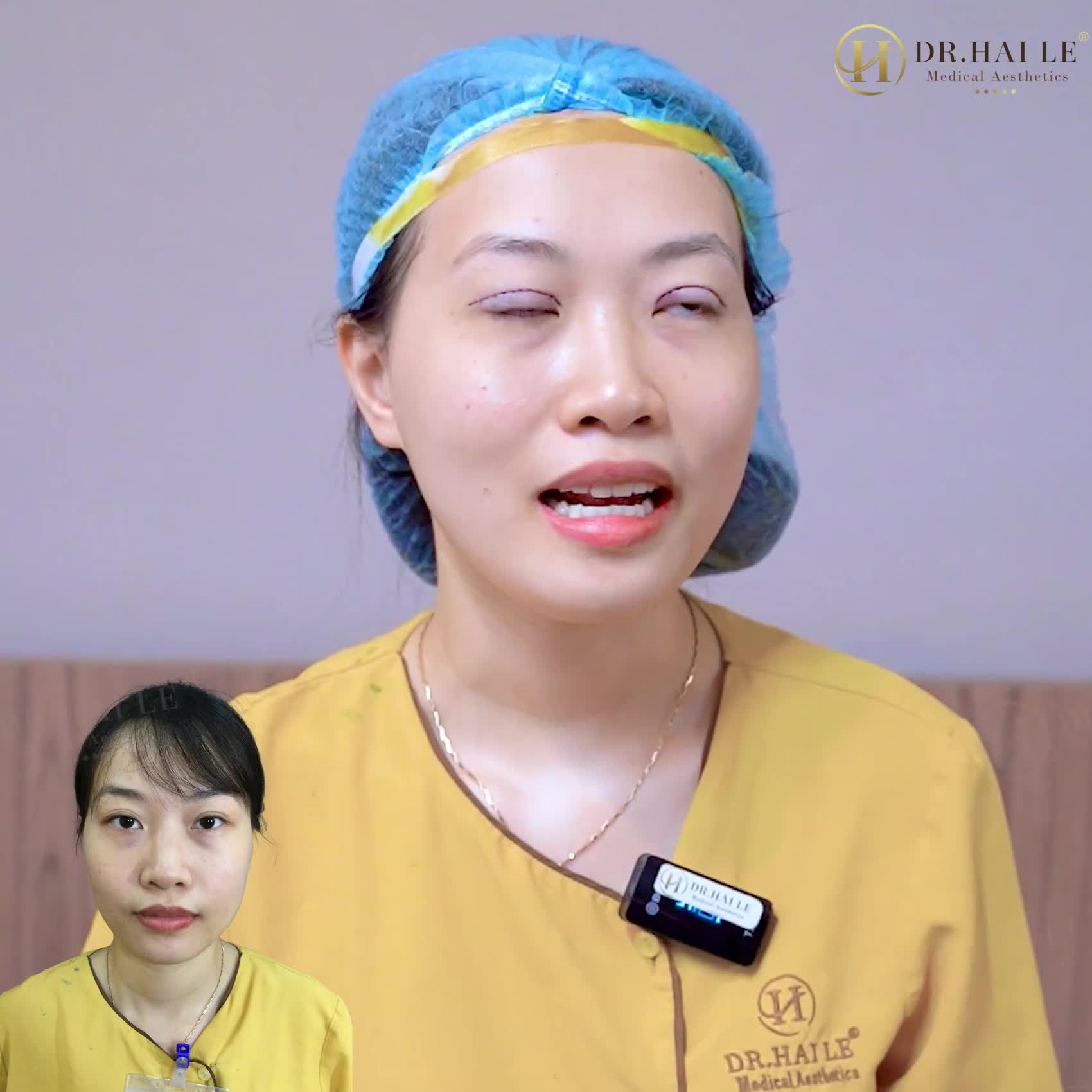 Cắt mí Dr.Hải Lê liệu có đẹp NHƯ LỜI ĐỒN