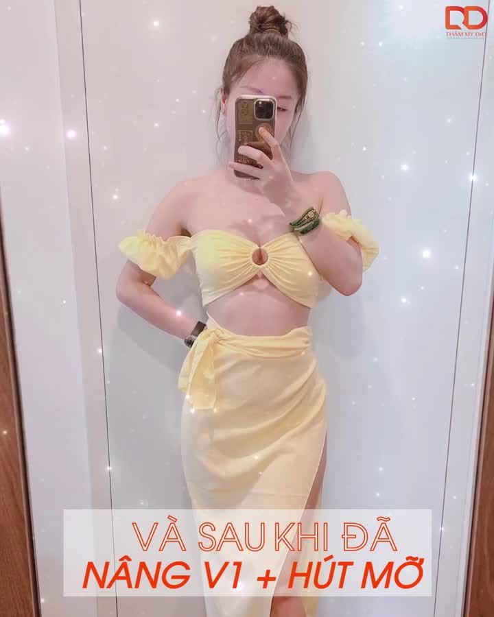 MẸ 3 CON ĐÃ THAY ĐỔI NHƯ THẾ NÀO SAU KHI THỰC HIỆN PHẪU THUẬT