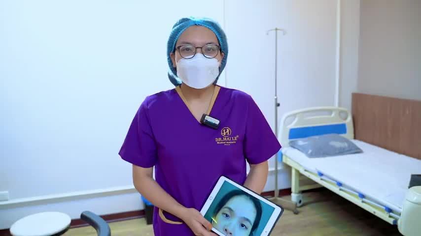 Cô giáo Mầm non thoát khỏi sụp mí bẩm sinh, tự tin hơn với đôi mắt của mình sau khi đến Dr.Hải Lê