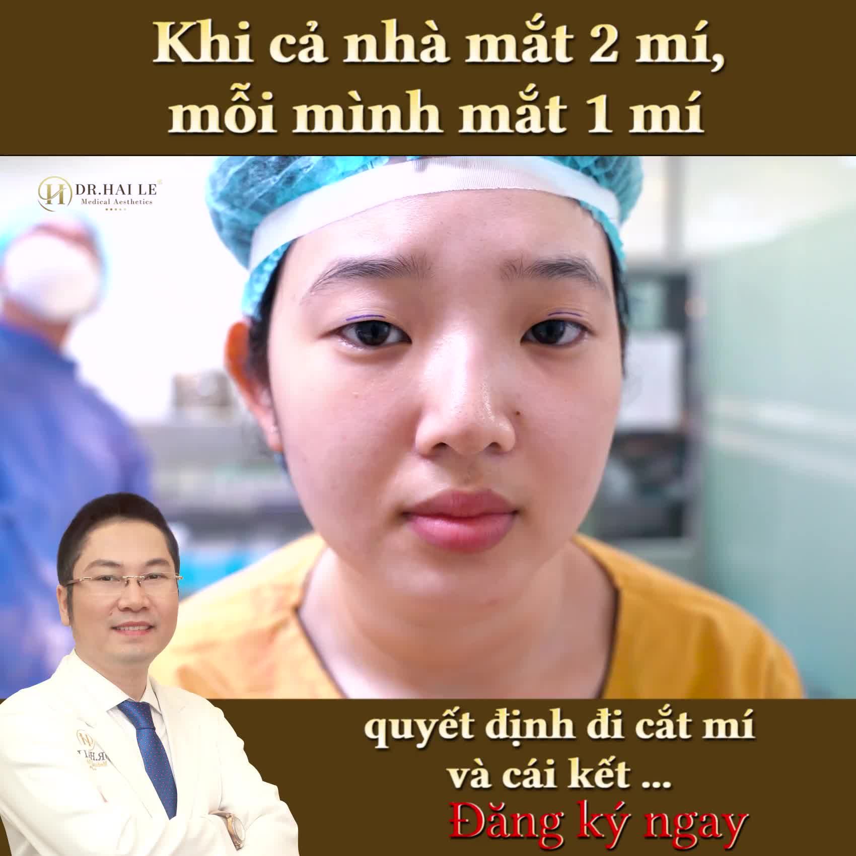 Khi cả nhà mắt 2 mí, mỗi mình mắt 1 mí...