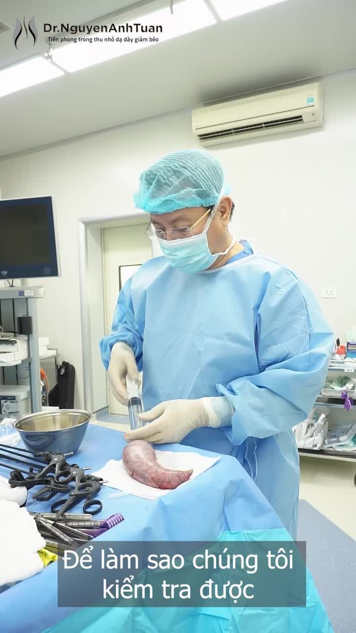PGS. TS. BS. Nguyễn Anh Tuấn thực hiện kiểm tra phần Dạ dày được loại bỏ sau phẫu thuật Thu nhỏ Dạ dày giảm béo