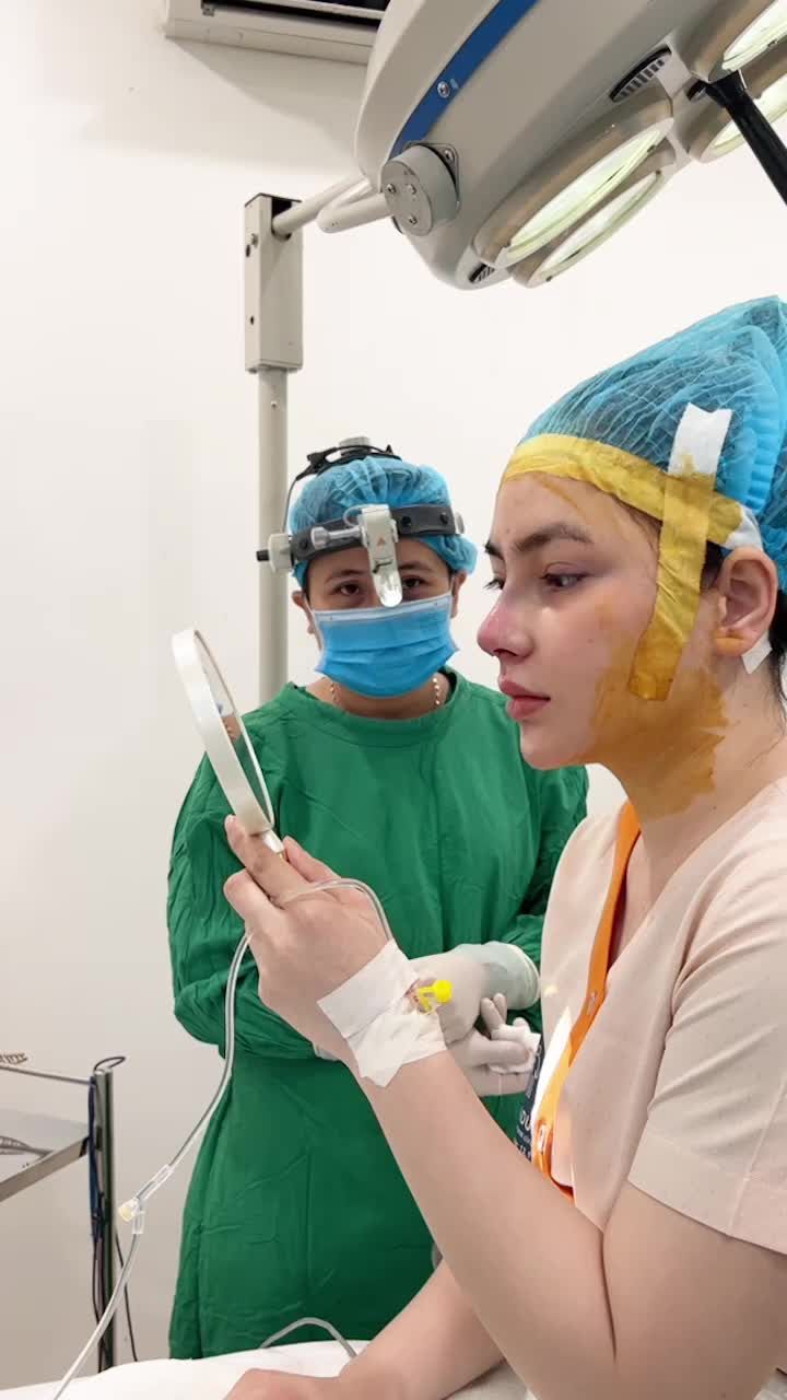 Khách hàng nâng mũi cấu trúc sụn tai + Surgiform + bọc Megaderm khắc phục tình trạng mỏng da , khách làm dáng Sline cao , kéo dài đầu mũi , đầu mũi bay nhẹ được thực hiện bởi bác sĩ Hoàng Nhung